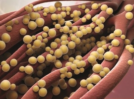 Staphylococcus aureus